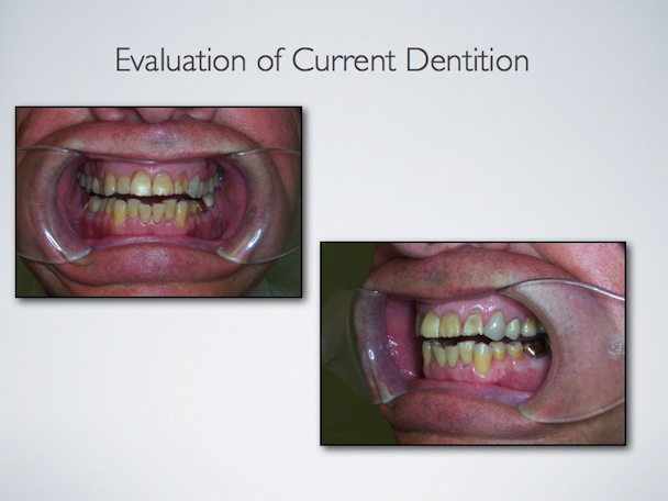 Smile design process image 2