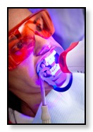 example-of-someone-having-laser-teeth-whitening